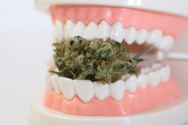 Does smoking weed affect dental implants